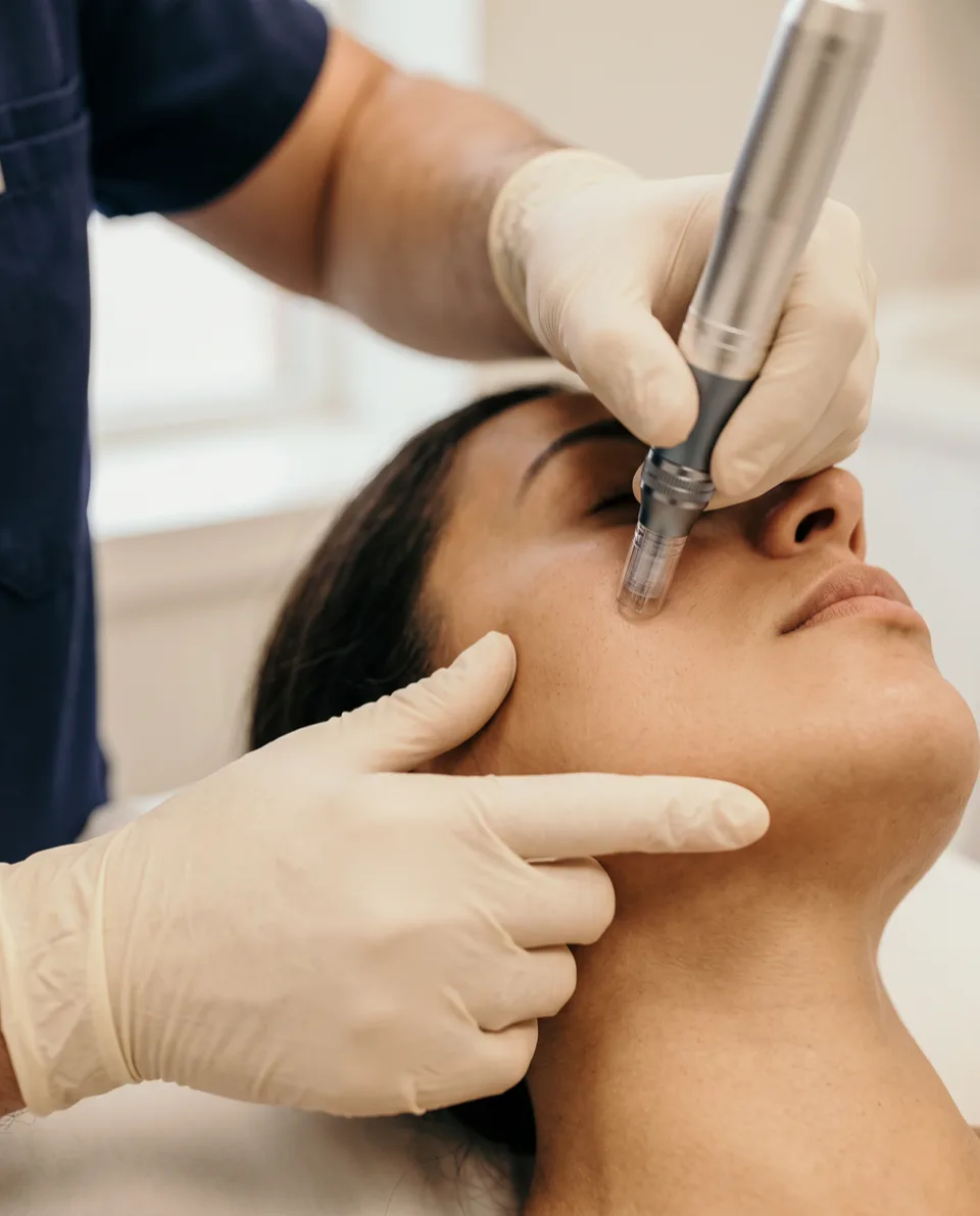 A physician's gloved hands drawing a microneedling pen across a patient's cheek.